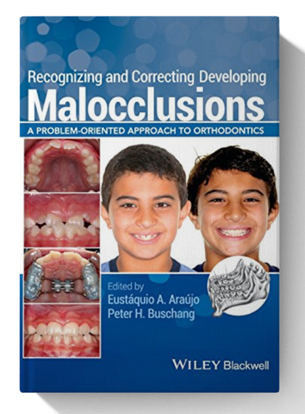 Recognizing and Correcting Developing Malocclusions: A Problem-Oriented Approach to Orthodontics 1st Edition