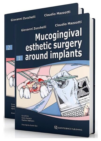 Mucogingival Esthetic Surgery Around Implants ( 2 Volumes)