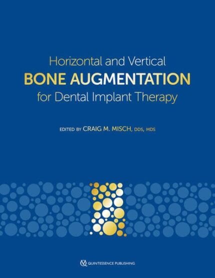 Horizontal and Vertical Bone Augmentation for Dental Implant Therapy