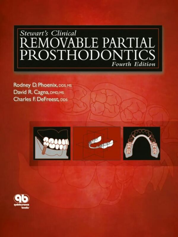 Stewart’s Clinical Removable Partial Prosthodontics, 4th Edition