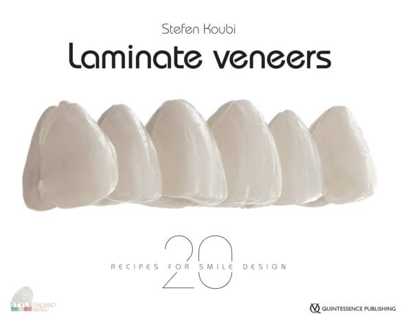 Laminate Veneers: 20 Recipes for Smile Design 1st Edition