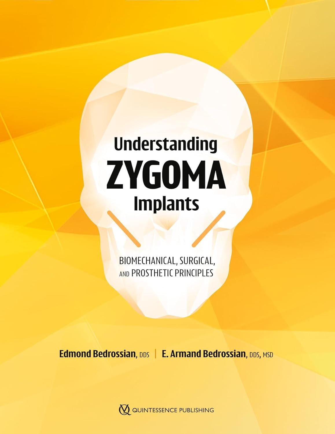 Understanding Zygoma Implants: Biomechanical, Surgical, and Prosthetic Principles