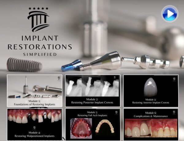 Implant Restorations Simplified: Restore Dental Implants with Accuracy & Confidence (Surgical Master)