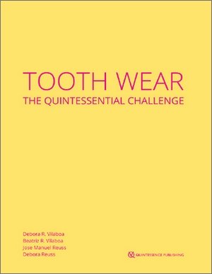 Tooth Wear The Quintessential Challenge