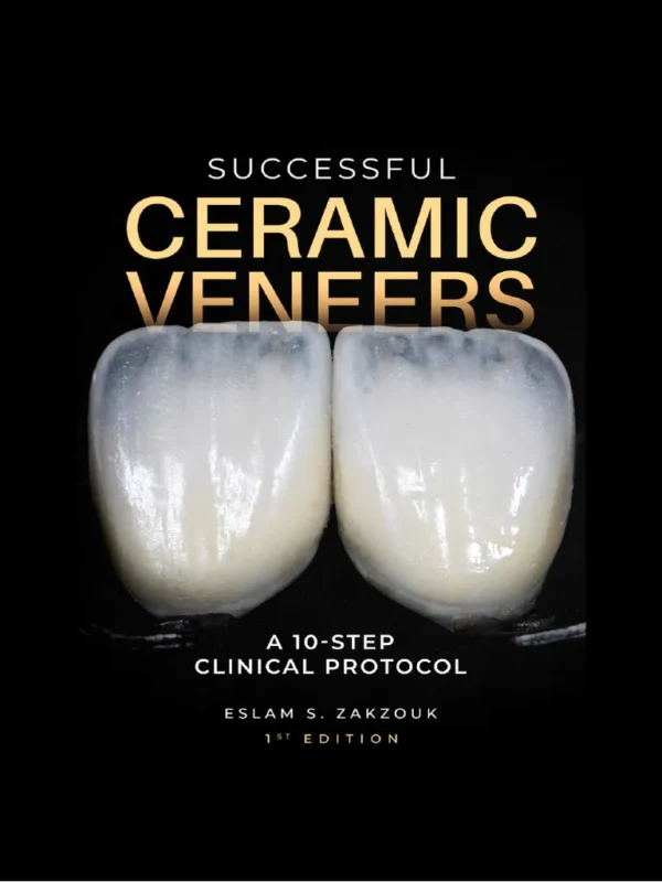 successful ceramic veneers 10 step clinical protocol