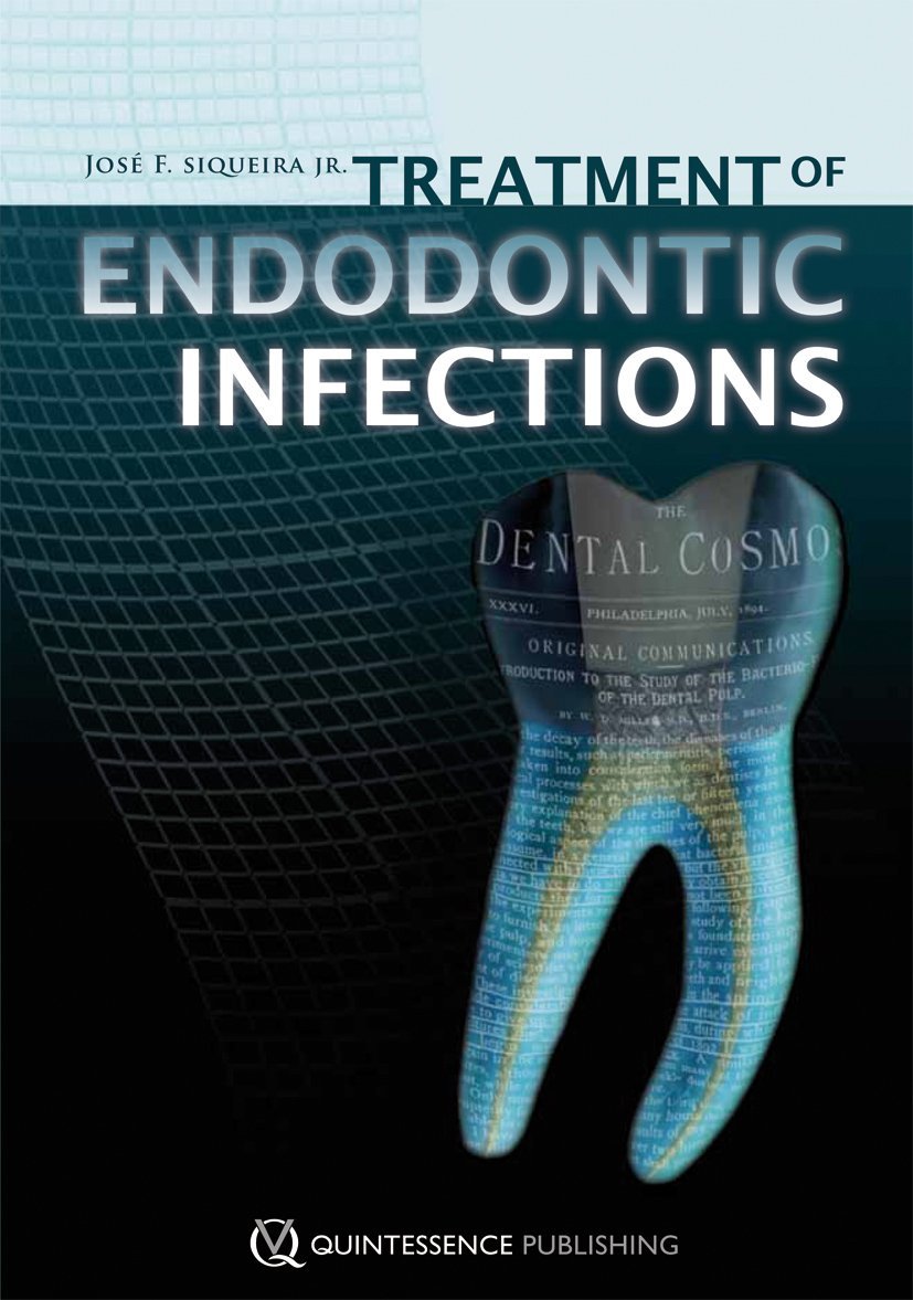 Treatment of Endodontic Infections 1st Edition